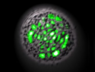 Die lebende GFP-produzierende Zelle dient als Kern des ersten lebenden Lasers (Malte Gather)