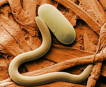 Fadenwurm Heterodera glycines (Agricultural Research Service) Fadenwurm Heterodera glycines (Agricultural Research Service)