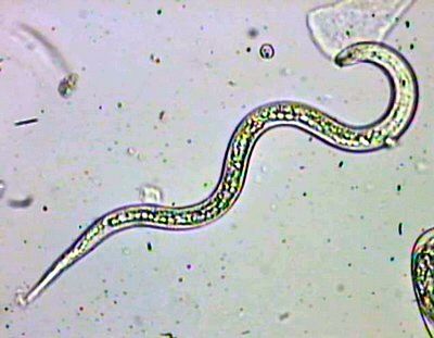 Halicephalobus mephisto (Property of the University of Gent, Belgium - Gaetan Borgonie)