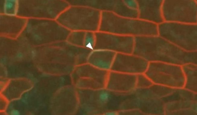 Entstehung eines Stoma (Image courtesy of Norwich BioScience Institutes) Entstehung eines Stoma (Image courtesy of Norwich BioScience Institutes)