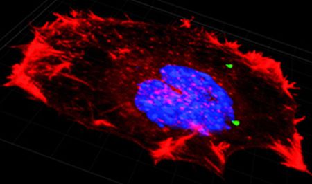 Krebszelle (rot mit blauem Nukleus) verschluckt zwei große Mikropartikel (grün) (Dr Davidson Ateh, BioMoti Limited)