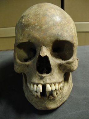 Ein Schädel vom East Smithfield Black Death Cemetery (Museum of London)