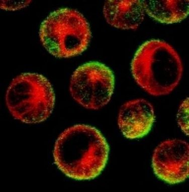Dieses Bild zeigt kanzeröse B-Zellen, die mit Rituximab behandelt wurden. Das Protein CD20 (grün) wurde auf eine Seite der Zellen gezogen. Wenn sich die natürlichen weißen Blutzellen nähern, haben sie eine 80-prozentige Wahrscheinlichkeit, die Zelle zu töten, wenn sie sich an die Seite anheften, an der sich das Protein angesammelt hat. (MCCIR)