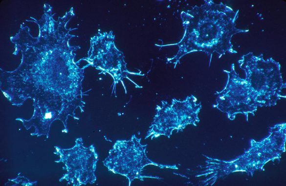 Krebszellen in menschlichem Bindegewebe, 500-fach vergrößert. (Dr. Cecil Fox / National Cancer Institute)