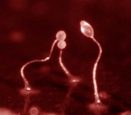 Dieses Bild zeigt Exemplare der Amöbengattung Dictyostelium. (Royal Holloway, University of London)