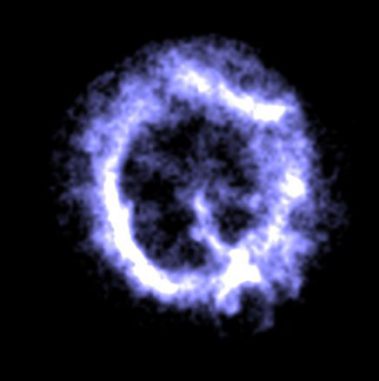 Chandra-Aufnahme des Supernova-Überrests E0102-72. (NASA / CXC / SAO)