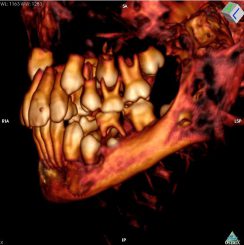 CT-Aufnahme des Schädels, auf der einige Milchzähne zu erkennen sind (Photo by David Hunt, Smithsonian Institution)