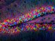 Bild eines transgenen Hippocampus einer Maus. (Nikon Small World Gallery)