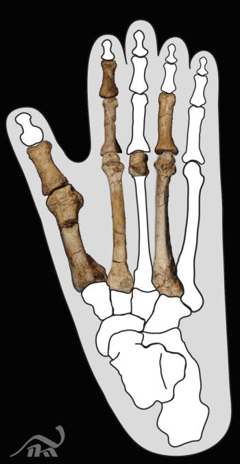Der unvollständige Burtele-Fuß, eingebettet in den Umriss eines Gorilla-Fußes (Copyright: The Cleveland Museum of Natural History, Photo courtesy: Yohannes Haile-Selassie)