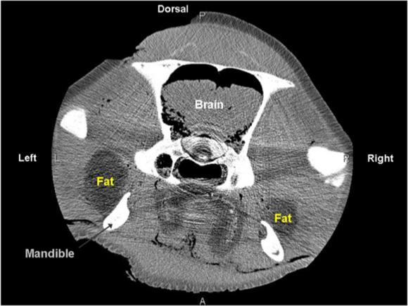 CT-Querschnitt durch den Kopf eines Minkwals. Das Fettgewebe ist mit den Kiefern verbunden. (Maya Yamato, Woods Hole Oceanographic Institution)
