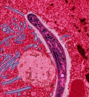 Falschfarbenaufnahme eines Malaria-Erregers der Gattung Plasmodium. (PloS / Image by Ute Frevert; false color by Margaret Shear)