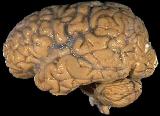 Ein menschliches Gehirn. (National Institutes of Health)
