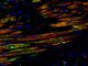 Bei diesem Bild zeigt Grün die von den transplantierten Stammzellen neugebildeten Myozyten. Rot stellt Myozyten dar, Blau die Zellkerne. Rot und Grün zusammen bedeutet, dass die transplantierten Stammzellen neue Myozyten gebildet haben. (Journal of the American College of Cardiology / Elsevier)