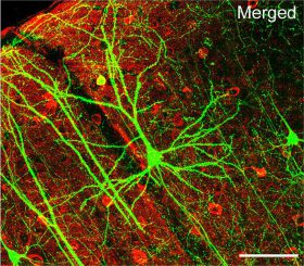 Ein Pyramiden-Neuron in der Großhirnrinde einer Maus. Die Verästelungen (Dendriten) sind gut erkennbar. (Wei-Chung Allen Lee, Hayden Huang, Guoping Feng, Joshua R. Sanes, Emery N. Brown, Peter T. So, Elly Nedivi)