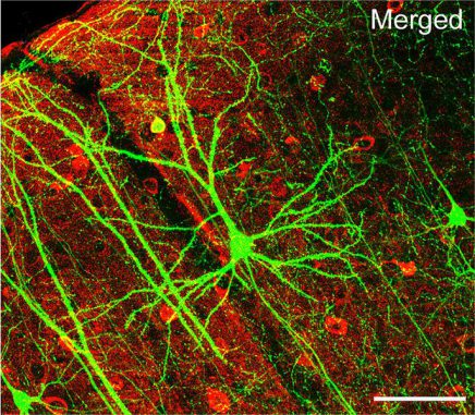Ein Pyramiden-Neuron in der Großhirnrinde einer Maus. Die Verästelungen (Dendriten) sind gut erkennbar. (Wei-Chung Allen Lee, Hayden Huang, Guoping Feng, Joshua R. Sanes, Emery N. Brown, Peter T. So, Elly Nedivi) Ein Pyramiden-Neuron in der Großhirnrinde einer Maus. Die Verästelungen (Dendriten) sind gut erkennbar. (Wei-Chung Allen Lee, Hayden Huang, Guoping Feng, Joshua R. Sanes, Emery N. Brown, Peter T. So, Elly Nedivi)