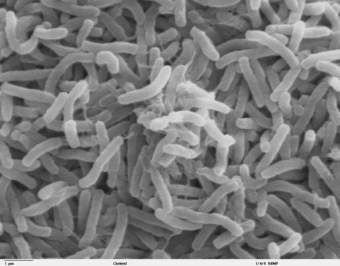Cholera-Bakterien, hier unter dem Elektronenmikroskop, sind nur eine von zahlreichen Bakterienarten. (Credit: Dartmouth College, Public Domain) Cholera-Bakterien, hier unter dem Elektronenmikroskop, sind nur eine von zahlreichen Bakterienarten. (Credit: Dartmouth College, Public Domain)