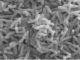 Cholera-Bakterien, hier unter dem Elektronenmikroskop, sind nur eine von zahlreichen Bakterienarten. (Credit: Dartmouth College, Public Domain)