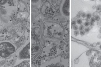 Elektronenmikroskopaufnahmen von marinen Bakterien, die mit den schwanzlosen Viren infiziert wurden. Die Bakterienzellen sind als lange, doppelte Linien erkennbar. Die Viren sind kleine runde Objekte mit dunklen Zentren. (Credits: MIT / Polz & Kauffman et al.)