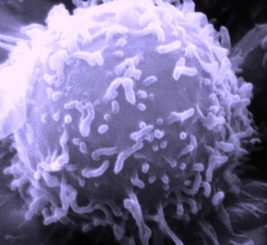 Elektronenmikroskopaufnahme eines menschlichen Lymphozyten. (Credits: Dr. Triche / National Cancer Institute)