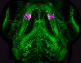 Eine regulatorische DNA-Sequenz in kiefertragenden Wirbeltieren markiert die Zellen des Kiefergelenks (Magenta) auf dem Hintergrund der Blutgefäße (Grün) im Kopf lebender Zebrafischlarven. (Credits: Photo / image: Laura Waldmann)